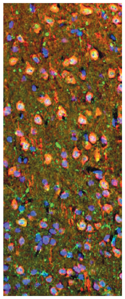 In this image from the brain of a mouse, the perineuronal net is visible as a scaffolding of widely spaced green dots. <strong>Science/AAAS</strong>